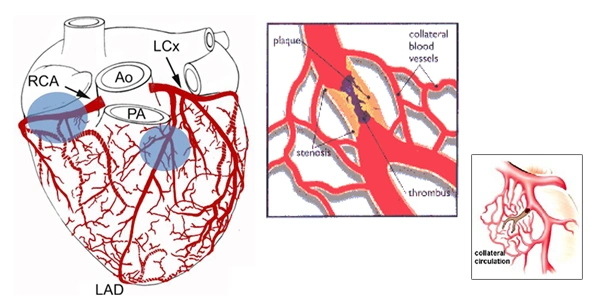 Eecps Machine for Cardiac Rehabilitation with Automatic System